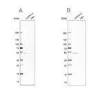 Western blot analysis using Anti-SPTLC1 antibody HPA010860 (A) shows similar pattern to independent antibody HPA063907 (B).