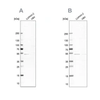 Western blot analysis using Anti-SPTLC1 antibody HPA010860 (A) shows similar pattern to independent antibody HPA063907 (B).