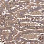 Immunohistochemical staining of human small intestine shows strong cytoplasmic granualr positivity in glandular cells.