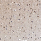 Immunohistochemical staining of human cerebral cortex shows moderate cytoplasmic positivity in glandular cells.