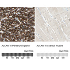 Anti-ALCAM Antibody