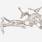 Immunohistochemical staining of human lung shows strong membranous positivity in pneumocytes.