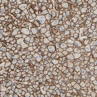 Immunohistochemical staining of human liver shows strong membranous positivity in hepatocytes.