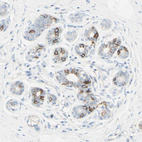 Anti-ALCAM Antibody