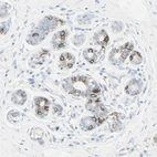 Immunohistochemical staining of human breast shows strong membranous positivity in glandular cells.