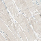 Immunohistochemical staining of human skeletal muscle shows no positivity in myocytes as expected.