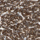 Immunohistochemical staining of human parathyroid gland shows strong membranous positivity.
