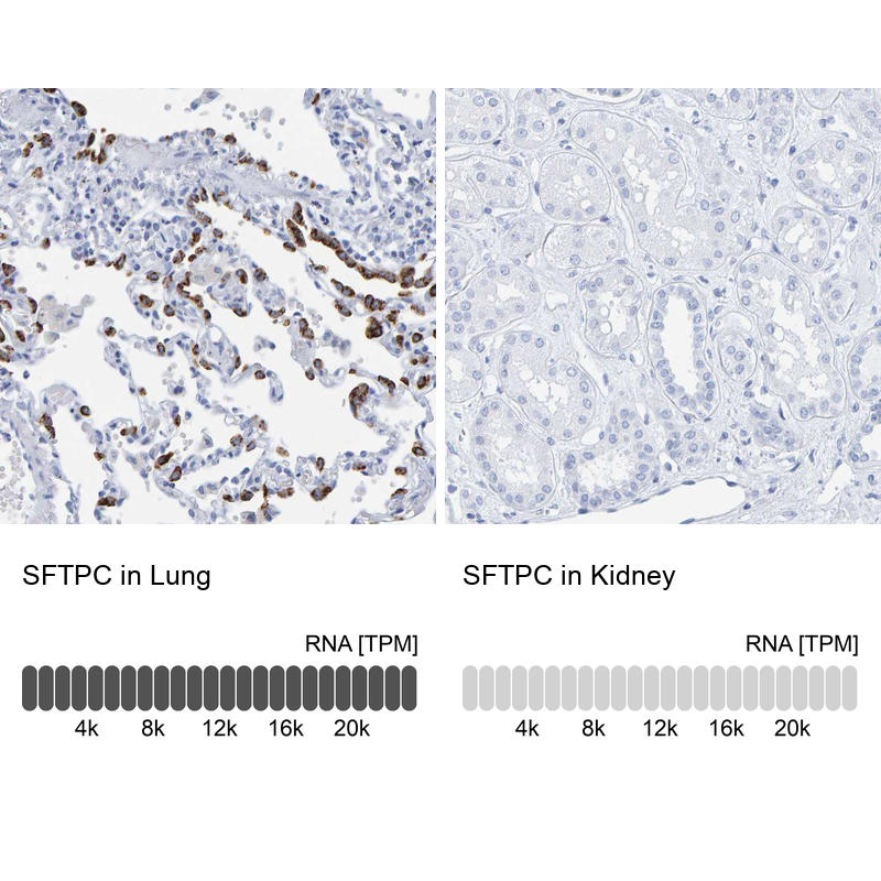 Anti-SFTPC Antibody