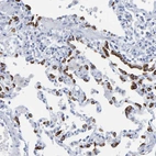 Immunohistochemical staining of human lung shows moderate to strong cytoplasmic positivity in respiratory epithelial cells.