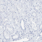Immunohistochemical staining of human kidney shows no positivity in cells in glomeruli as expected.