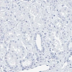 Immunohistochemical staining of human kidney shows no positivity in cells in glomeruli as expected.