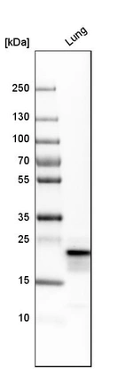 Western blot analysis in human lung tissue.