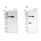 Western blot analysis using Anti-MTDH antibody HPA010932 (A) shows similar pattern to independent antibody HPA015104 (B).