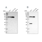Western blot analysis using Anti-MTDH antibody HPA010932 (A) shows similar pattern to independent antibody HPA015104 (B).