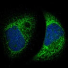 Immunofluorescent staining of human cell line A-431 shows localization to endoplasmic reticulum.