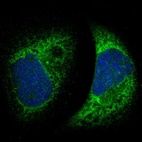 Anti-MTDH Antibody