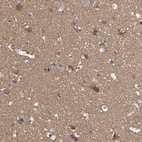 Anti-DPYSL3 Antibody