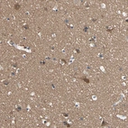 Anti-DPYSL3 Antibody