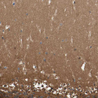 Immunohistochemical staining of human cerebellum shows strong cytoplasmic positivity in cells in molecular layer.