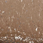 Immunohistochemical staining of human cerebellum shows strong cytoplasmic positivity in cells in molecular layer.