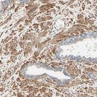 Immunohistochemical staining of human prostate shows moderate cytoplasmic positivity in smooth muscle cells.