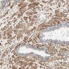 Immunohistochemical staining of human prostate shows moderate cytoplasmic positivity in smooth muscle cells.