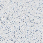 Immunohistochemical staining of human liver shows no positivity in hepatocytes as expected.