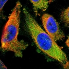 Immunofluorescent staining of human cell line U-251 MG shows localization to cytosol.