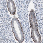 Anti-AGPAT5 Antibody