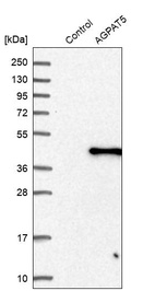 Western blot analysis in control (vector only transfected HEK293T lysate) and AGPAT5 over-expression lysate (Co-expressed with a C-terminal myc-DDK tag (~3.1 kDa) in mammalian HEK293T cells, LY413113).