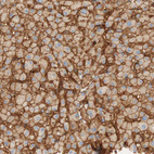 Immunohistochemical staining of human Liver shows strong membranous and cytoplasmic positivity in hepatocytes.