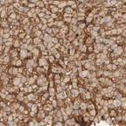 Immunohistochemical staining of human Liver shows strong membranous and cytoplasmic positivity in hepatocytes.
