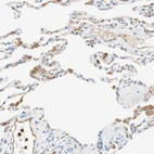 Immunohistochemical staining of human lung shows moderate membranous and cytoplasmic positivity in macrophages and pneumocytes.