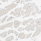 Immunohistochemical staining of human Skeletal muscle shows no membranous positivity in myocytes.