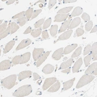 Immunohistochemical staining of human Skeletal muscle shows no membranous positivity in myocytes.