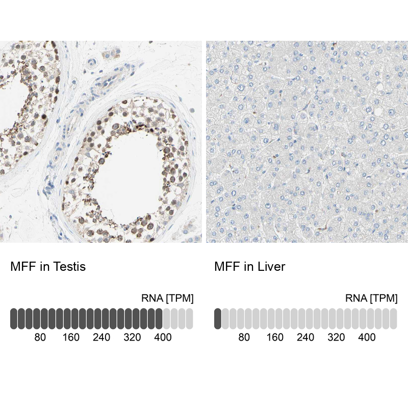 Anti-MFF Antibody