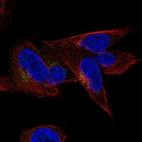Anti-CCDC126 Antibody