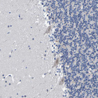 Immunohistochemical staining of human cerebellum shows moderate cytoplasmic positivity in Purkinje cells.