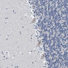 Immunohistochemical staining of human cerebellum shows moderate cytoplasmic positivity in Purkinje cells.