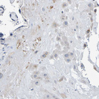 Immunohistochemical staining of human placenta shows moderate cytoplasmic - membranous positivity in decidual cells.