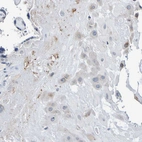 Immunohistochemical staining of human placenta shows moderate cytoplasmic - membranous positivity in decidual cells.
