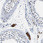 Immunohistochemical staining of human testis shows strong cytoplasmic positivity in Leydig cells.