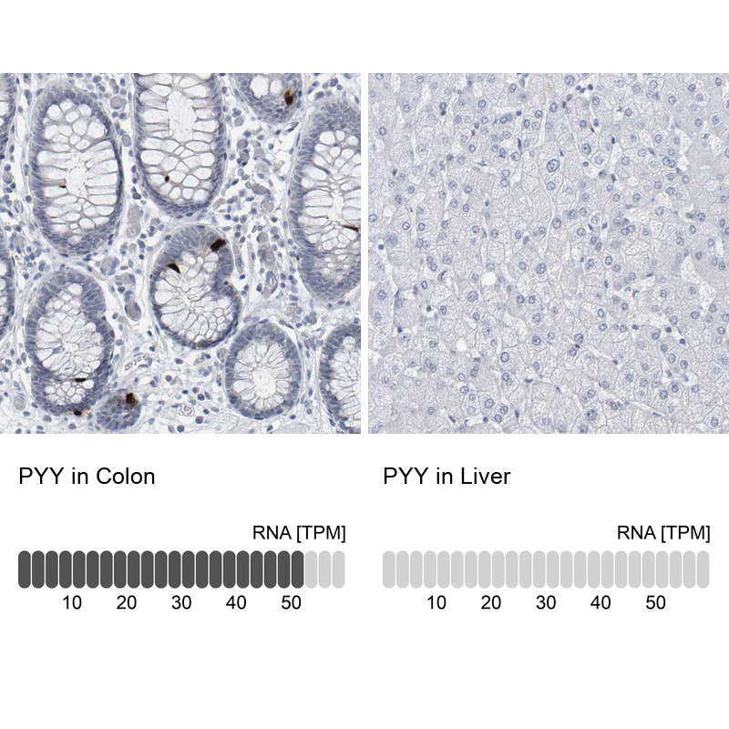 Anti-PYY Antibody