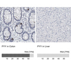 Anti-PYY Antibody