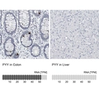 Anti-PYY Antibody