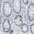 Immunohistochemical staining of human colon shows strong cytoplasmic positivity in enteroendocrine cells.