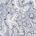 Immunohistochemical staining of human small intestine shows strong cytoplasmic positivity in enteroendocrine cells.
