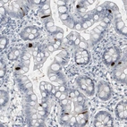 Immunohistochemical staining of human small intestine shows strong cytoplasmic positivity in enteroendocrine cells.