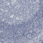 Immunohistochemical staining of human tonsil shows no positivity as expected.