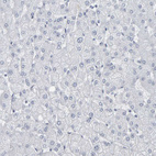 Immunohistochemical staining of human liver shows no positivity in hepatocytes as expected.